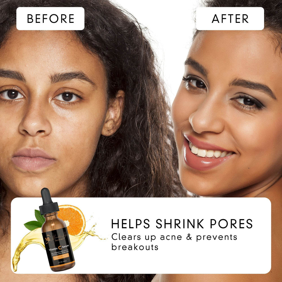 Vitamin C Serum – Brightening & Firming - MIRA MORA