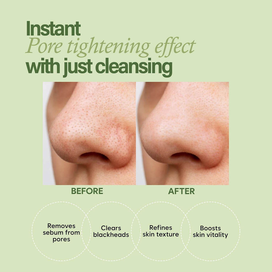 Avocado Pore Cleanser Pack – Deep Clean & Tighten - MIRA MORA